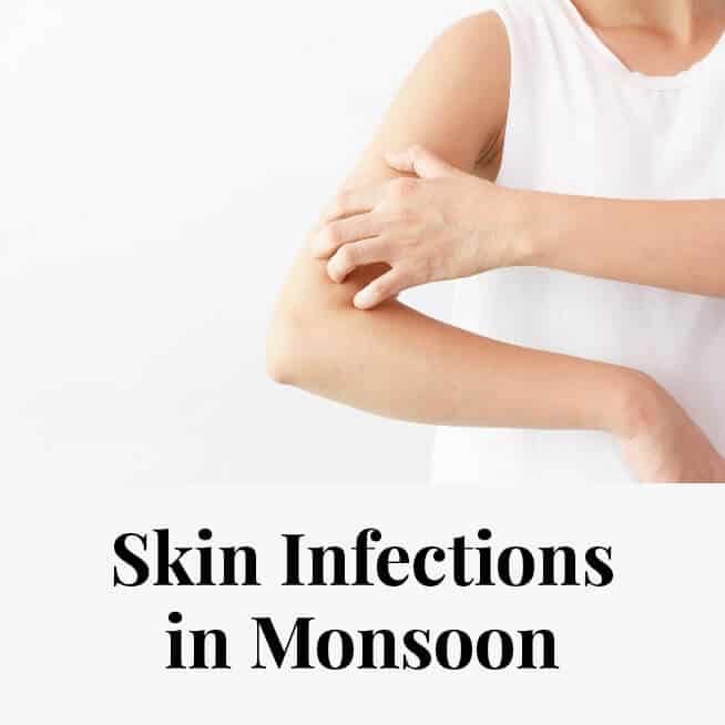 Skin Infections in Monsoon